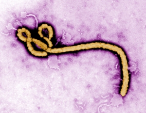 Center for Disease Control image of the Ebola virus.